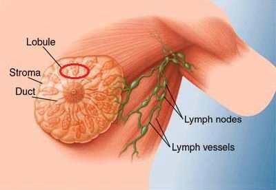 Name:  r7_breast_zpsd5afb841.jpg
Views: 875
Size:  30.0 KB