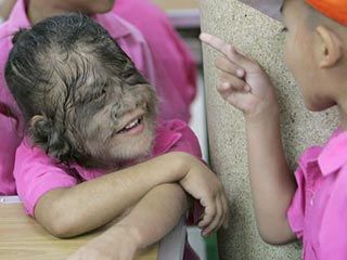 Name:  werewolf_syndrome_004.jpg
Views: 899
Size:  18.1 KB