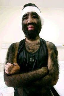 Name:  werewolf_syndrome_011.jpg
Views: 986
Size:  14.1 KB