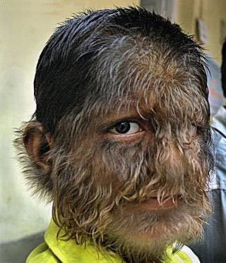 Name:  werewolf_syndrome_013.jpg
Views: 1342
Size:  31.4 KB