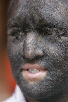 Name:  werewolf_syndrome_016.jpg
Views: 1990
Size:  16.9 KB