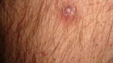Name:  b4hxzb_th-1.jpg
Views: 139
Size:  2.7 KB
