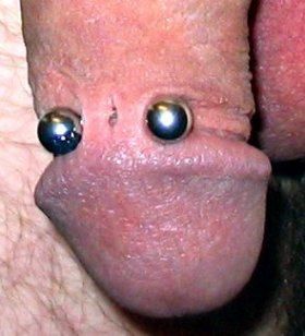 trauma_infant_circumcison_020.jpg
