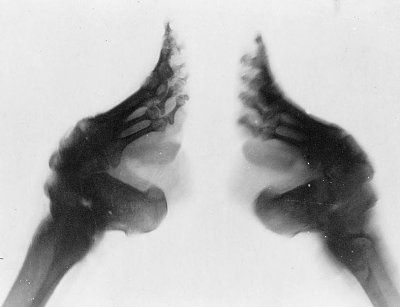 chinese_foot_binding_zps93c710dd.jpg