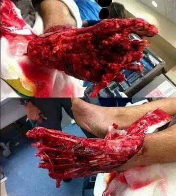 motorcycle-foot-skinned.jpg