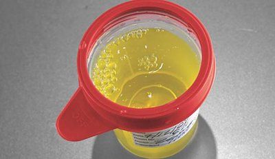 urine.jpg