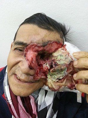 man-peels-face.jpg
