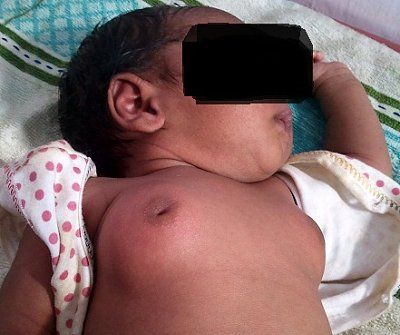 babyboobs.jpg