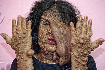 sarotin-skin-condition-3116960.jpg