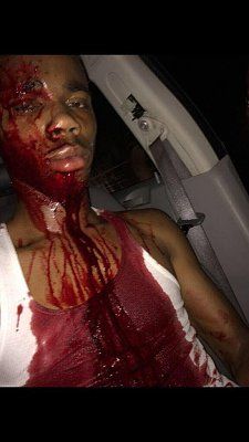 man-shot-head.jpg