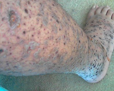 unknown-leg-problem-2.jpg