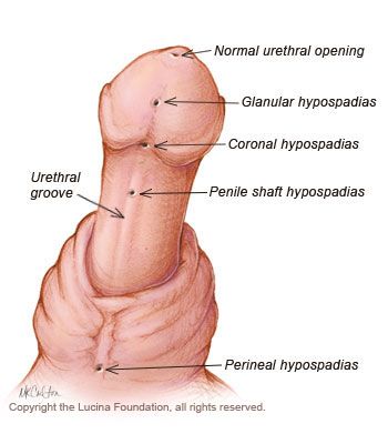 penis2.jpg