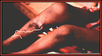 drac1.gif