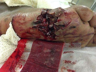 shot-foot.jpg