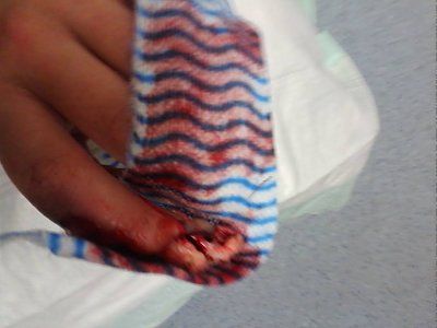 bloody-20finger-201.jpg