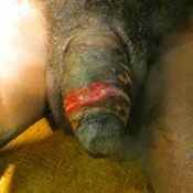 13%20%20Gangrene%20%28mild%29.jpg