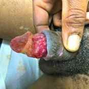 17%20%20Large%20wound.jpg
