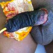20%20%20Gangrene.jpg