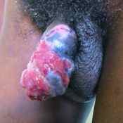 41%20%20Deformed.jpg