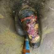 47%20%20Gangrene%20%28a%29.jpg