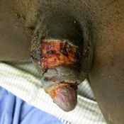 53%20%20Large%20wound%20%28a%29.jpg