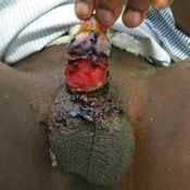 53%20%20Large%20wound%20%28b%29.jpg