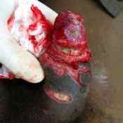 57%20%20Large%20wound%20%28a%29.jpg