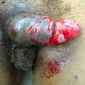 57%20%20Large%20wound%20%28b%29.jpg
