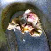 63%20%20Gangrene%20%28b%29.jpg