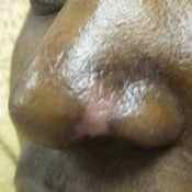 65%20%20Nose%20pulling.jpg