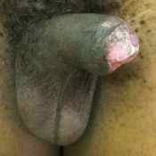 66%20%20Deformed%20%28a%29.jpg