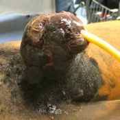 94%20%20Gangrene%20%28a%29.jpg