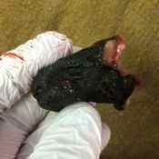 97%20%20Gangrene%20%28c%29.jpg