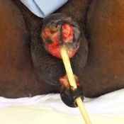 105%20%20Gangrene%20%28b%29.jpg