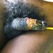 108%20%20Gangrene%20%28a%29.jpg