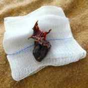 108%20%20Gangrene%20%28b%29.jpg