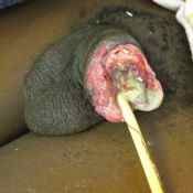 112%20%20Gangrene%20%28b%29.jpg
