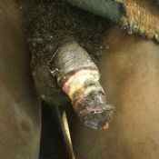 130%20%20Gangrene.jpg