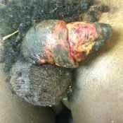 134%20%20Gangrene%20%28a%29.jpg