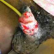 134%20%20Gangrene%20%28b%29.jpg
