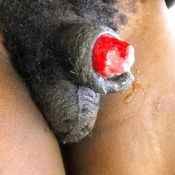 134%20%20Gangrene%20%28c%29.jpg