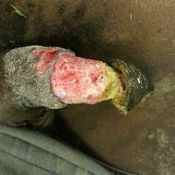 139%20%20Gangrene%20%28a%29.jpg
