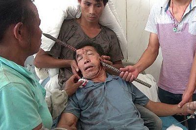 man-survived.jpg