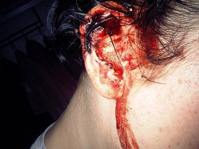 earpiercinggonewrong.jpg