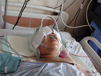 main-worker-scalped-accident-chicken-farm-dalian-chinas-liaoning-province.jpg