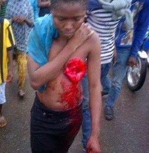 breast-cut-off-e1407583276846.jpg