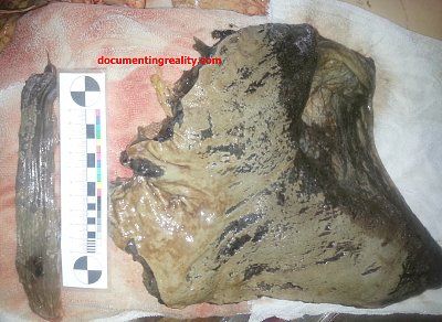 acid-esophagus-stomach1.jpg