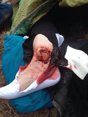 horse-fall.jpg
