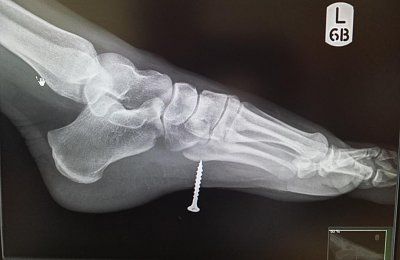 xray-1.jpg
