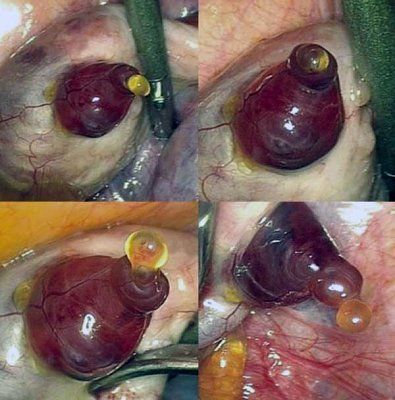 egg-emerging-ovary.jpg